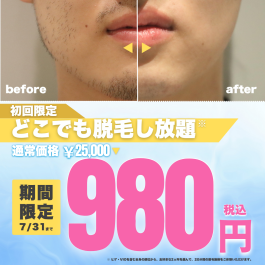 ＼【夏本番】肌見せの季節、ムダ毛ケアはお済みですか？／メンズ脱毛サロン「メンズクリア」初回体験980円！